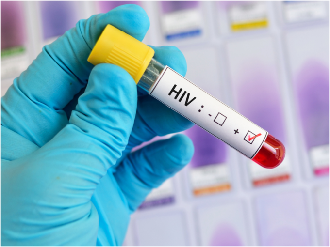 What is the difference between HIV and AIDS?