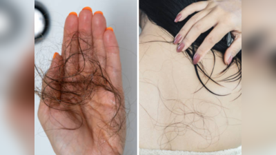 वयाच्या 30 नंतर सतत गळणाऱ्या केसांपासून सुटका मिळवायची असेल, तर वापरा ही क्लृप्ती, १००% मिळणार रिझल्ट