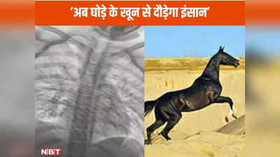 Good News: जब इंसान नहीं आए काम तब घोड़े के खून ने बचाई जान, इंदौर के डॉक्‍टरों ने किया ऐसा कमाल