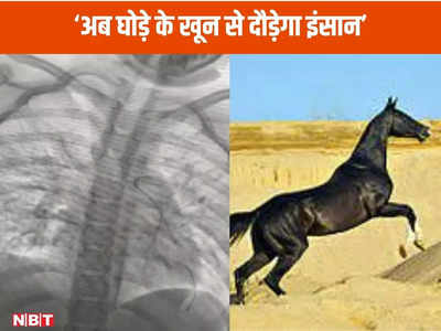 Good News: जब इंसान नहीं आए काम तब घोड़े के खून ने बचाई जान, इंदौर के डॉक्‍टरों ने किया ऐसा कमाल