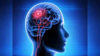 Early Symptoms Of Brain Tumor: दिमाग में बनने जा रही है कैंसर की गांठ, ये पहला लक्षण दिखते ही भागें डॉक्टर के पास