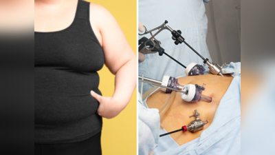लठ्ठपणापासून मुक्तता: बॅरिएट्रिक सर्जरी नेमकी केव्हा करावी? तज्ज्ञांचा सल्ला