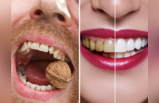 White Teeth Remedy: दांतों को चट्टान बनाते हैं 6 काम, 100 साल तक चमकेगी बत्तीसी, पल में तोड़ देंगे अखरोट