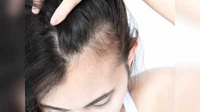 Hair Regrowth Solution: মাথার সামনে থেকে ফাঁকা হয়ে যাচ্ছে চুল? চিন্তায় ঘুম ওড়ার আগে লাগিয়ে নিন এই ম্যাজিক জেল