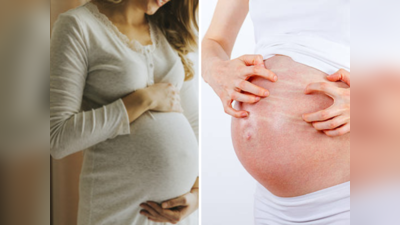 गर्भावस्थेत अंगाला खाज सुटतेय? इंट्राहेपॅटिक कोलेस्टेसिसची समस्या म्हणजे नेमके काय