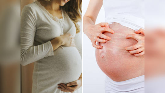 गर्भावस्थेत अंगाला खाज सुटतेय? इंट्राहेपॅटिक कोलेस्टेसिसची समस्या म्हणजे नेमके काय