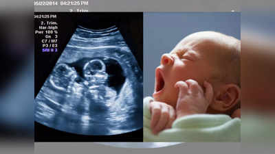 गर्भात जुळी, अल्ट्रासाऊंडमध्येही दिसली, पण जन्माला आलं एकच बाळ; रुग्णालयात खळबळ