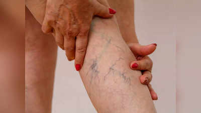 Leg Pain Reason: पैरों के दर्द को न करें नजरअंदाज, इन 5 गंभीर बीमारियों का संकेत देते हैं दुखते पैर