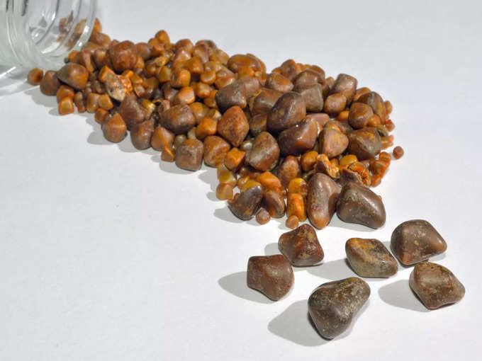 ​Gallstones பித்தப்பை கற்கள் பாதிப்பு​