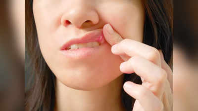 Mouth Ulcer Remedy: মুখের ভিতরের ঘা নিয়ে নাজেহাল? চোখের নিমেষে উপশম দেবে মা-ঠাকুমার এই টোটকাই