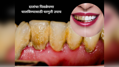 दातांवर जमलाय पिवळा थर हसण्याची वाटतेय लाज, ५ पदार्थ त्वरीत घालवतील दातांचा पिवळेपणा