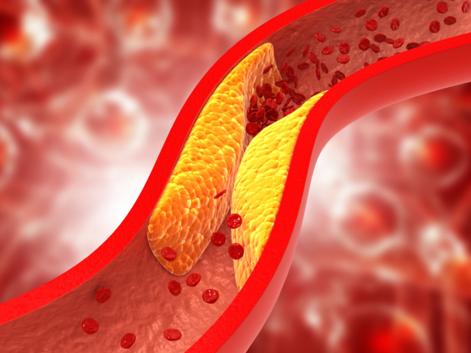 cholesterol artery blood flow
