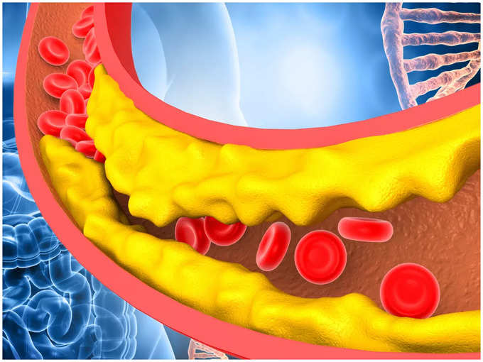ಕೊಲೆಸ್ಟ್ರಾಲ್ ವಿಚಾರದಲ್ಲಿ ಭಯ ಬೇಡ