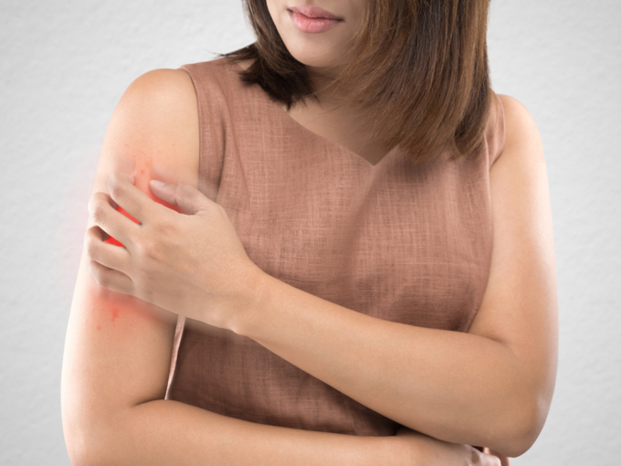 rashes itching skin problem