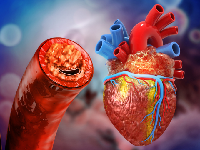 healthy heart vessel artery