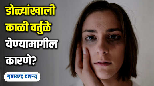 what causes dark circles under the eyes watch video