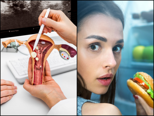 Endometriosis Diet: ఈ ఆహారం ఎక్కువగా తింటే.. గర్భసంచి ఆరోగ్యం దెబ్బతింటుంది..!