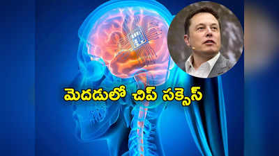 Elon Musk: తొలిసారి మనిషి మెదడులో వైర్‌లెస్ చిప్.. మరో సంచలనానికి ఎలాన్ మస్క్ శ్రీకారం 