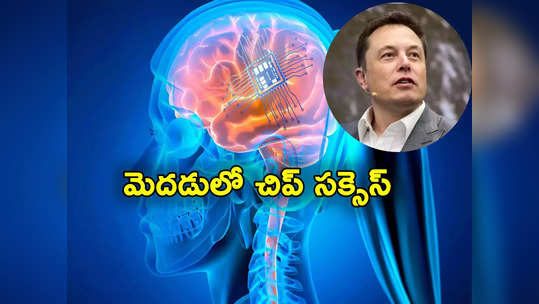 Elon Musk: తొలిసారి మనిషి మెదడులో వైర్‌లెస్ చిప్.. మరో సంచలనానికి ఎలాన్ మస్క్ శ్రీకారం 