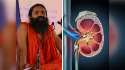 Kidney Stones : मुतखडे विरघळून लघवीतून पडतील झटक्यात बाहेर, करा रामदेव बाबांचे हे उपाय, औषध व ऑपरेशनची गरज नाही