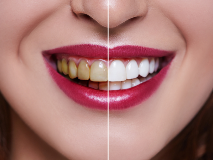 oral health white teeth