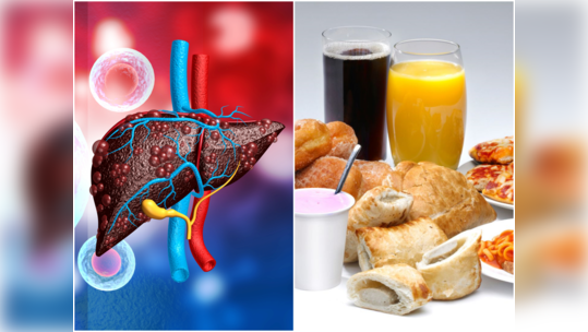 Liver Diet:మందు తాగితేనే కాదు.. ఈ ఫుడ్స్‌ తిన్నా లివర్‌కు మంచిది కాదు..!