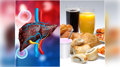 Liver Diet:మందు తాగితేనే కాదు.. ఈ ఫుడ్స్‌ తిన్నా లివర్‌కు మంచిది కాదు..!