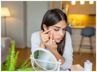 Pimples: ఇలా చేస్తే మొటిమలు త్వరగా తగ్గిపోతాయి..