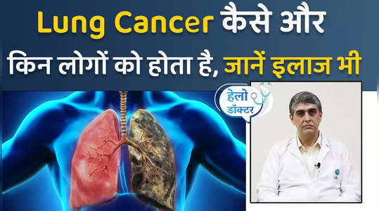 expert explained treatment option for lung cancer watch video