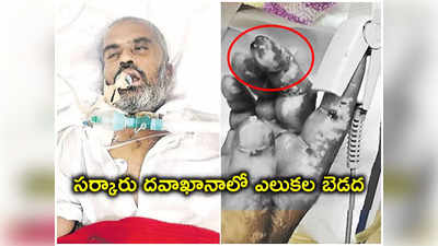 కామారెడ్డి ప్రభుత్వాసుపత్రిలో దారుణం.. ఐసీయూలో రోగిని కరిచిన ఎలుకలు