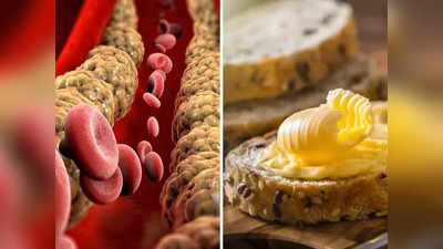 High Cholesterol: हाई कोलेस्ट्रॉल में मक्खन खाना चाहिए या नहीं? न्यूट्रिशनिस्ट ने बताया हेल्दी रहने का असली तरीका