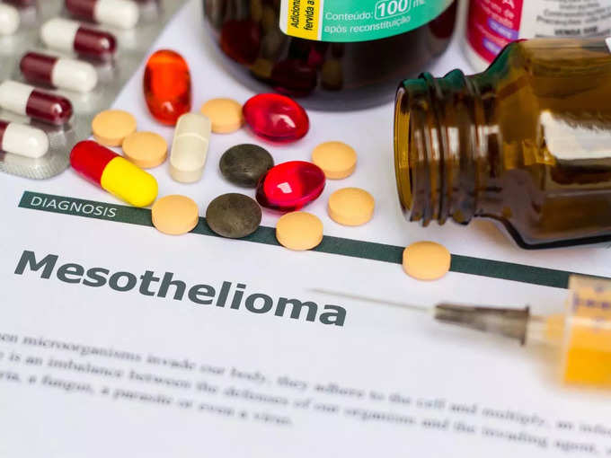 मेसोथेलियोमा कैंसर के लक्षण और इलाज