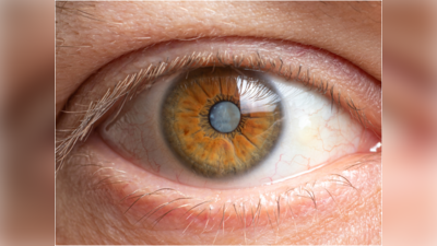 Glaucoma: ಕಣ್ಣಿಗೆ ಹೆಚ್ಚು ಒತ್ತಡ ಹಾಕಿದ್ರೆ ದೃಷ್ಟಿ ನರ ಹಾನಿಯಾಗುತ್ತಂತೆ ಎಚ್ಚರ!