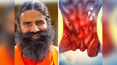 Piles Home Remedies: खूनी-बादी, दोनों तरह की बवासीर होगी जड़ से खत्म, बाबा रामदेव के 4 नुस्खे देगे तुरंत आराम
