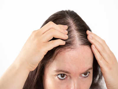 Hair Problem Solution: এই ভিটামিনেই বন্ধ হবে চুল ঝরা, ফাঁকা মাথায় গজাবে নতুন চুলও