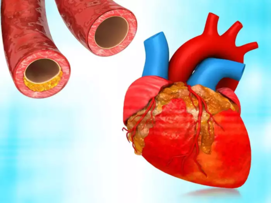 5 मिनिटांत या पद्धतीने ओळखा हृदयाच्या नसांत ब्लॉकेज आहे की नाही? रिझल्टमध्ये ही 5 लक्षणे दिसली तर डॉक्टरकडे पळा