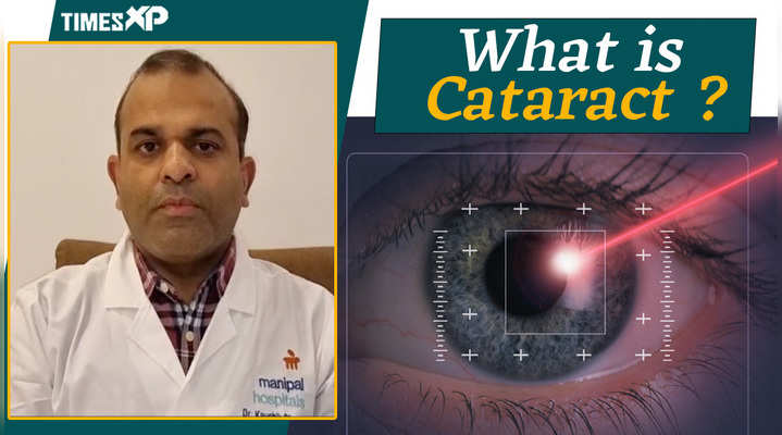 what is cataract watch video