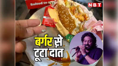 बॉलीवुड सिंगर रविंद्र उपाध्याय का बर्गर खाते हुए टूटा दांत, पढ़ें ऑनलाइन ऑर्डर और डिलीवरी के बाद क्या क्या हुआ