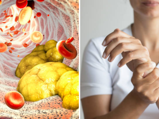 हाताला मुंग्या किंवा बोटं अचानक वाकडी होतात? मग मर्यादेपलिकडे वाढलंय Cholesterol असा करा उपाय