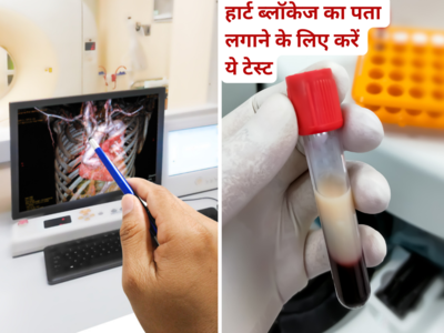 ​चलते-फिरते आ रहे हैं Heart Attack, करा लें ये 2 जरूरी टेस्‍ट, पता चल जाएगा कितनी हो चुकी है ब्‍लॉकेज