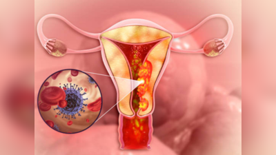 आंतरराष्ट्रीय महिला दिनानिमित्त जागरूकता, ही आहेत Ovarian Cancer ची लक्षणे