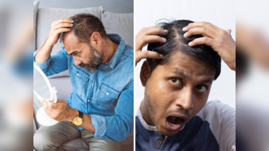 टक्कल पडणारच नाही, डोक्यावरचे केस पातळ होऊ लागले असतील तर या 5 Supplementsने मिळवा घनदाट केस
