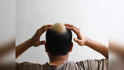 Hair Regrowth Solution: পেঁয়াজের রসের সঙ্গে মিশিয়ে নিন এই জিনিসগুলি, চকচকে টাকেও হুড়হুড়িয়ে গজাবে চুল