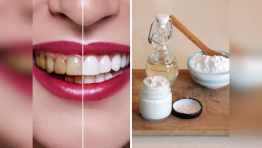 Teeth Whitening: दातावरील पिवळा थर घालवायला वापरताय लिंबू रस, बेकिंग सोडा? वापरणे योग्य की अयोग्य