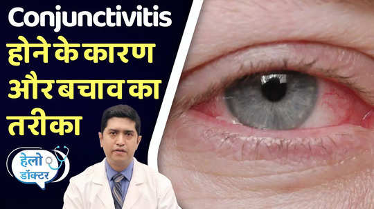 what is eye flu and its types know some tips from expert to prevent pink eye or conjunctivitis
