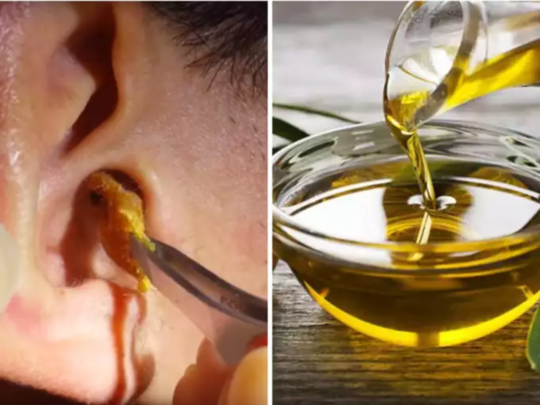 Best Oil To Remove Earwax : कानात साचलेला पूर्ण चिकट मळ स्वत:हून पडेल बाहेर, फक्त कानात घाला या तेलाचे दोन थेंब 