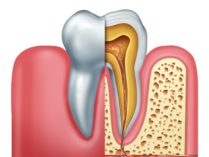 root canal surgery oral health