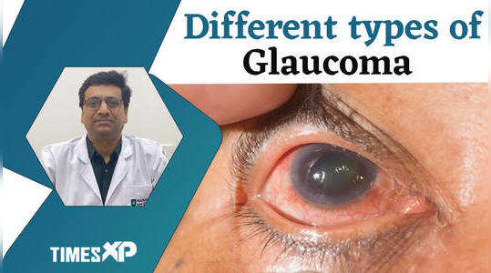 glaucoma types risks and importance of regular eye check ups watch video