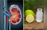 World Kidney Day: घूंट-घूंट गटक लेना ये 6 चीजें, किडनी से खुद निकल जाएंगे विषाक्त पदार्थ, पथरी का होगा चूरा