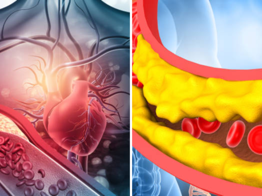 नसांमध्ये कोलेस्टेरॉल मर्यादेपलिकडे वाढलाय? तर बोटांवर दिसतात ही भयंकर लक्षणे 